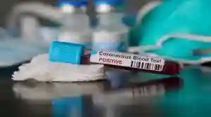 Zimbabwe Coronavirus Cases Rise To 40